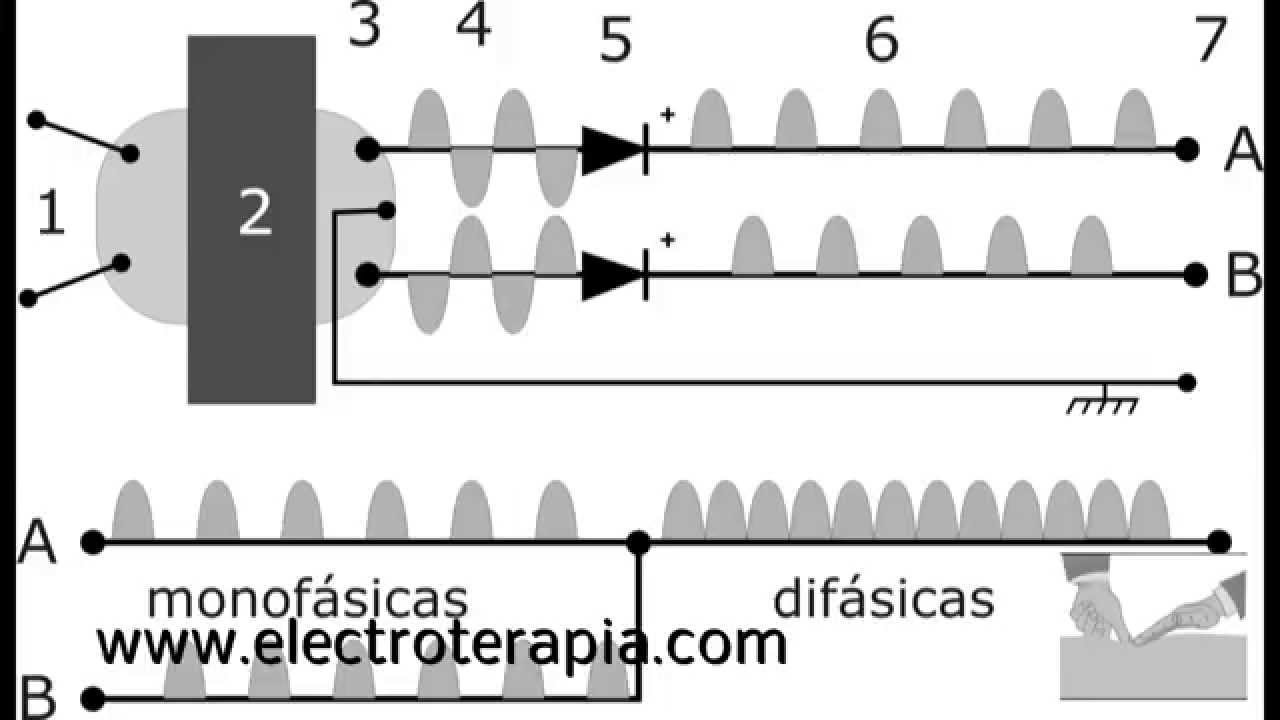 Tipos de corrientes diadinámicas y sus aplicaciones en rehabilitación  física - Abilita