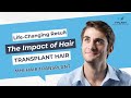 Lifechanging results the impact of hair transplant surgery  hair transplant