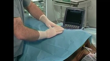 #107 Intercostal Nerve Block: Ultrasound Guided Technique | Reviewed by Elsevier | Cheap Ebooks