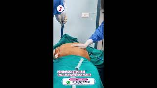 Liposuction surgery in delhi Lucknow Raipur Kolkata surat baroda jaipur patna ranchi hyderabad pune