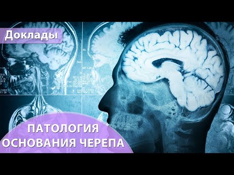 Патология основания черепа. Андрей Мангов