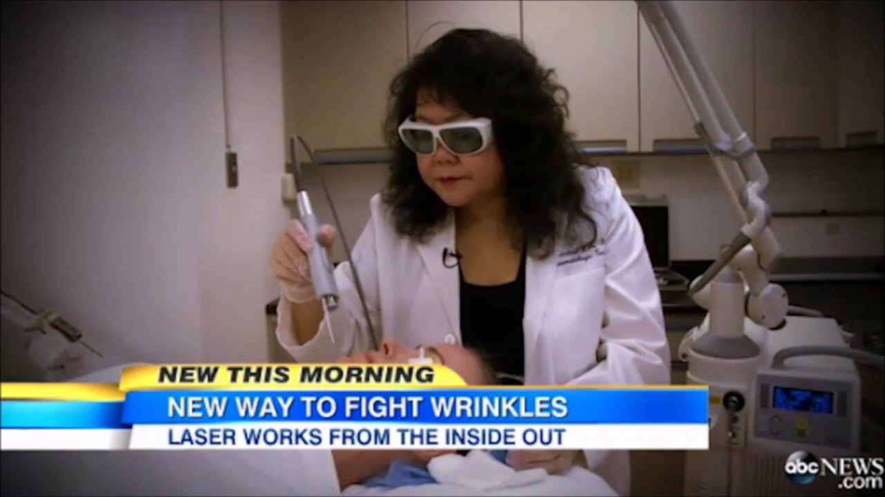 non-surgical facelift at Absolute Medi Spa