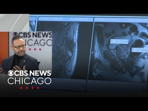 Cook County Commissioner Bill Lowry on his prostate screening program 