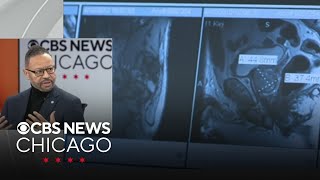 Cook County Commissioner Bill Lowry on free cancer screening program
