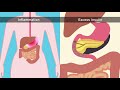 How does obesity cause cancer?