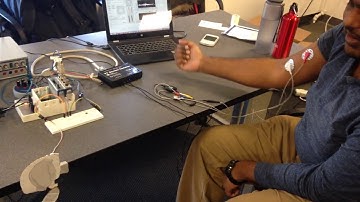 EEG Controlled Robotic Arm