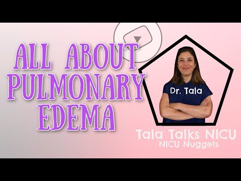 What causes Neonatal Pulmonary Edema - NICU Nuggets - Tala Talks NICU