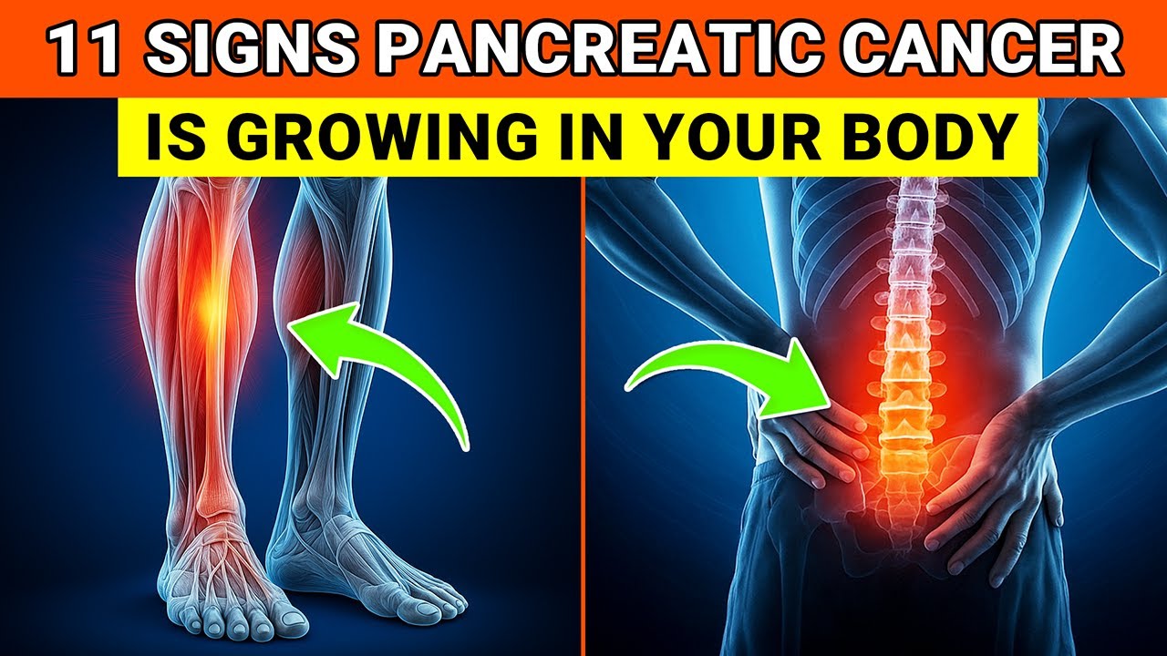 Don't Miss These 11 Early Signs of Pancreatic Cancer - This Could Save ...