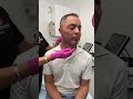 Skin Tacking for Jawline Contouring with AGNES Ultra | Brandie Heredia | Agnes Medical
