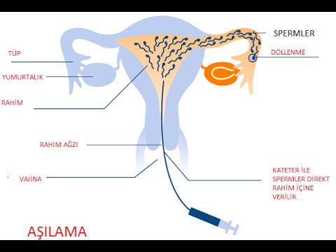 Aşılama Nedir? - Op. Dr. Emre Karatekelioğlu