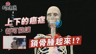 鎖骨淋巴腫起來 竟是 胃癌 口腔癌 肺癌 警訊?【VR挖健康】EP22 陳欣湄醫師