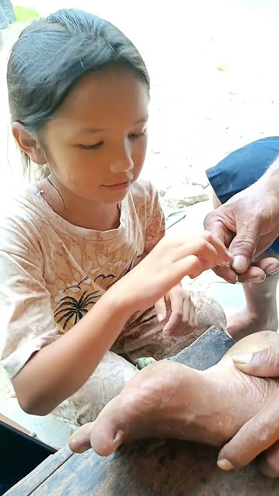 When Father Uda Ara's Leg Was Pierced by a Salak Thorn. Bagas Told Uda to Be Careful 🙆‍♂️❤