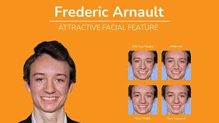 What makes Frederic Arnault so attractive