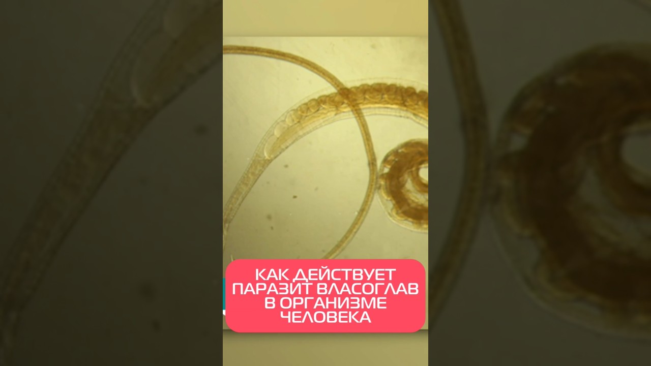 Власоглав в человеке