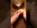Apple Vs Long Toenails Natural