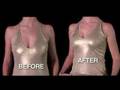 Liftys Invisible Bra Breast Lift