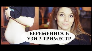 БЕРЕМЕННОСТЬ 16-20 НЕДЕЛЬ- Senya Miro БЕРЕМЕННОСТЬ 16-20 НЕДЕЛЬ- Senya Miro