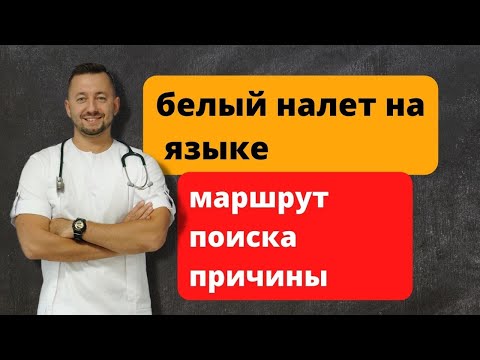 БЕЛЫЙ НАЛЕТ на языке. Маршрут поиска причины.