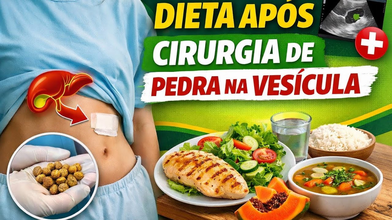 Dieta após cirugia de PEDRA NA VESÍCULA. - YouTube