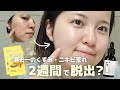 【透明感ケア】くすみ・ニキビ跡が気になる方必見👀🚨2週間でトーンアップ&ニキビ跡を薄くする方法🫧 #美白ケア #保湿ケア #ナンバーズイン
