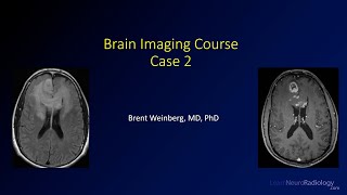 Brain imaging course - Unknown case 2