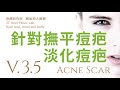 針對撫平痘疤與淡化痘疤 (All Types Acne Scar) - 3.5版本 - 請閱讀影片使用說明 (建議使用耳機聆聽)