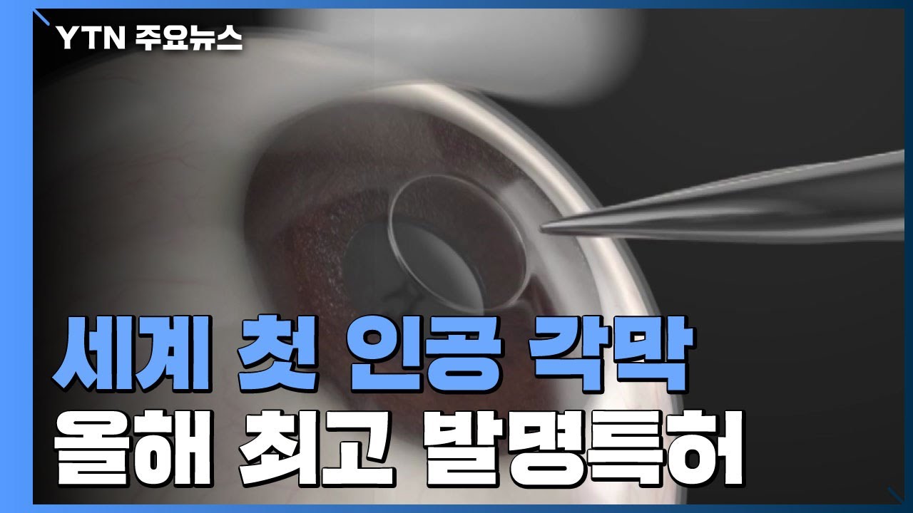 세계 첫 '인공 각막' 상용화 임박...올해 최고 발명특허 / YTN
