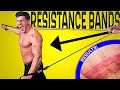 Creating the WORST RESISTANCE BAND INJURY of all Time *EXTREME BRUISING* | Bodybuilder VS Pain Test