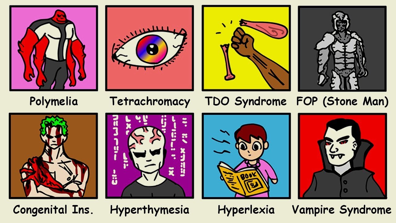 Những Căn Bệnh Khiến Con Người Giống Siêu Nhân Trong 10 Phút