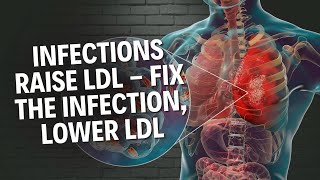 How Parasites and Other Infections Raise LDL Which Fights Them