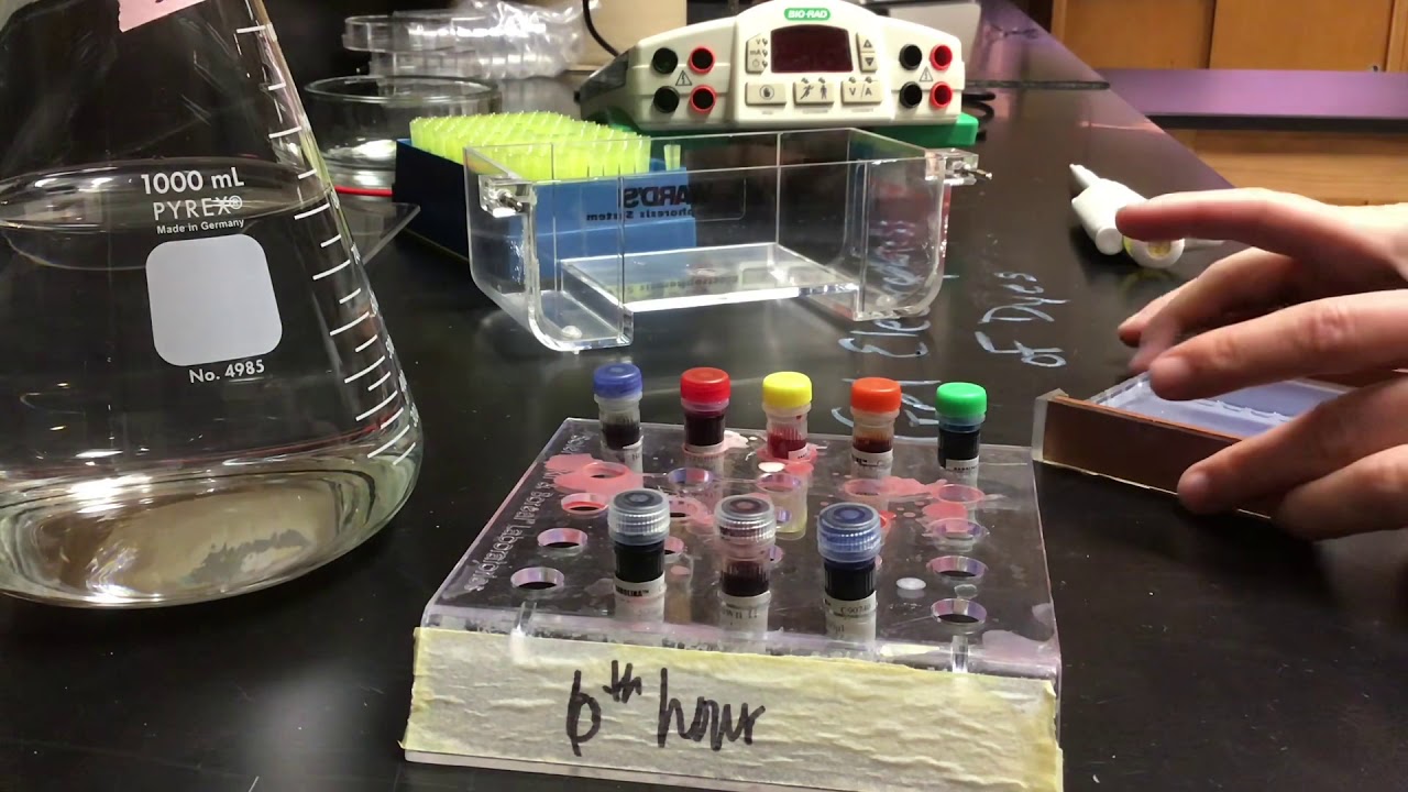 Gel Electrophoresis of Dyes YouTube