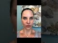 Dr. Greer Tries Restylane Kysse Filler! | Greer Plastic Surgery