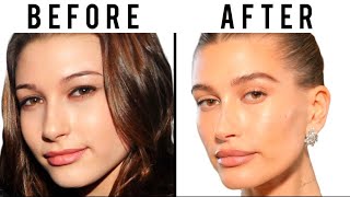 Is Hailey Bieber's Face All Natural? | Plastic Surgery Analysis