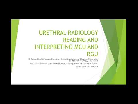 How to read MCU and RGU Part 1