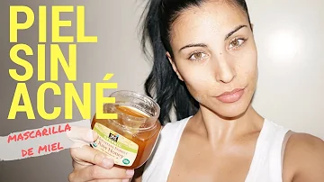 ¿Se puede utilizar la miel para el acné?