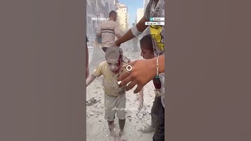 Bleeding Palestinian child left in shock after Israeli attack