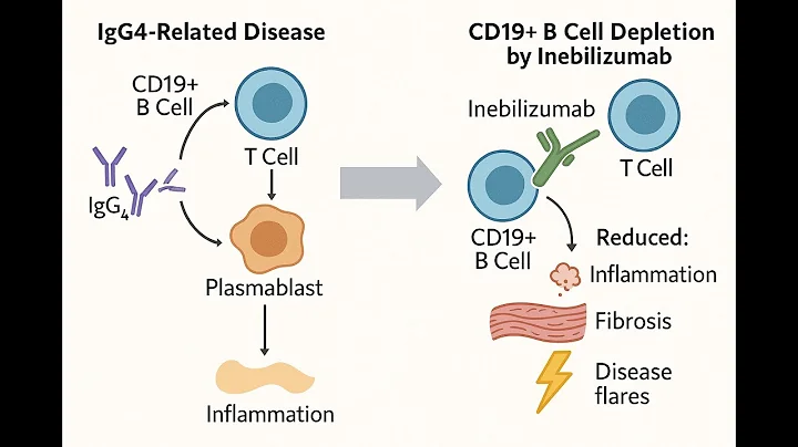 Inebilizumab for IgG4-Related Disease: Key Takeaways from the MITIGATE Trial