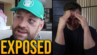 Tyson Fury was Exposed…