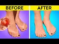 Easy Ways to Keep Your Feet Fresh And Smooth