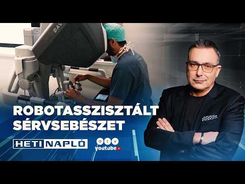 Miért fontosak a betéti limiterek?