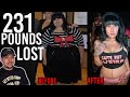 The SCARY Reality Of Weight Loss & Loose Skin Surgery