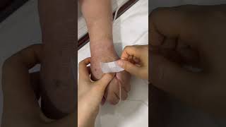 💉 Nurse Daily Life | Expert IV Cannulation Skills & Hospital Vlog #shorts