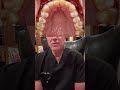 Lingual braces used to sound niche, now they're mainstream. Hidden placement used to mean compromise