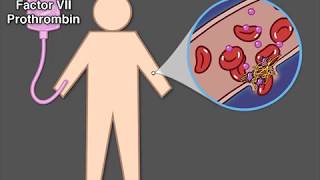 Treating Hemophilia A