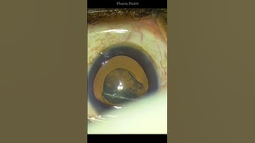 Hydro-delineation-  doing it perfectly