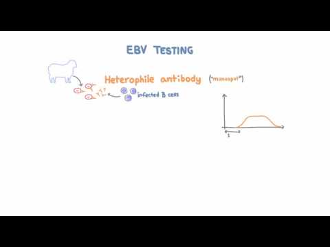 Epstein Barr Virus (EBV) Diagnosis and Testing