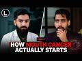 DENTIST REVEALS THE TRUTH | Oral Cancer, Root Canal Myths &amp; More | Episode 1 - Part 2