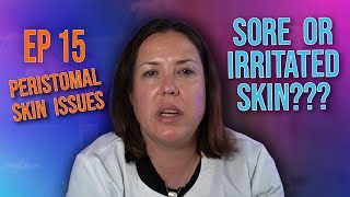 Episode 15 Peristomal Skin Issues