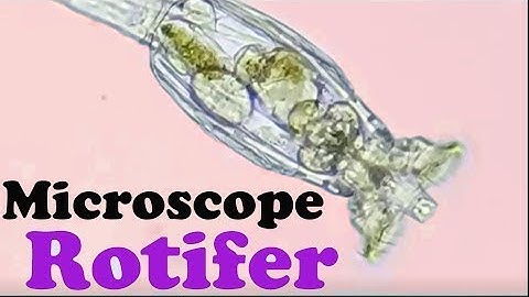 Rotifers Swimming And Eating