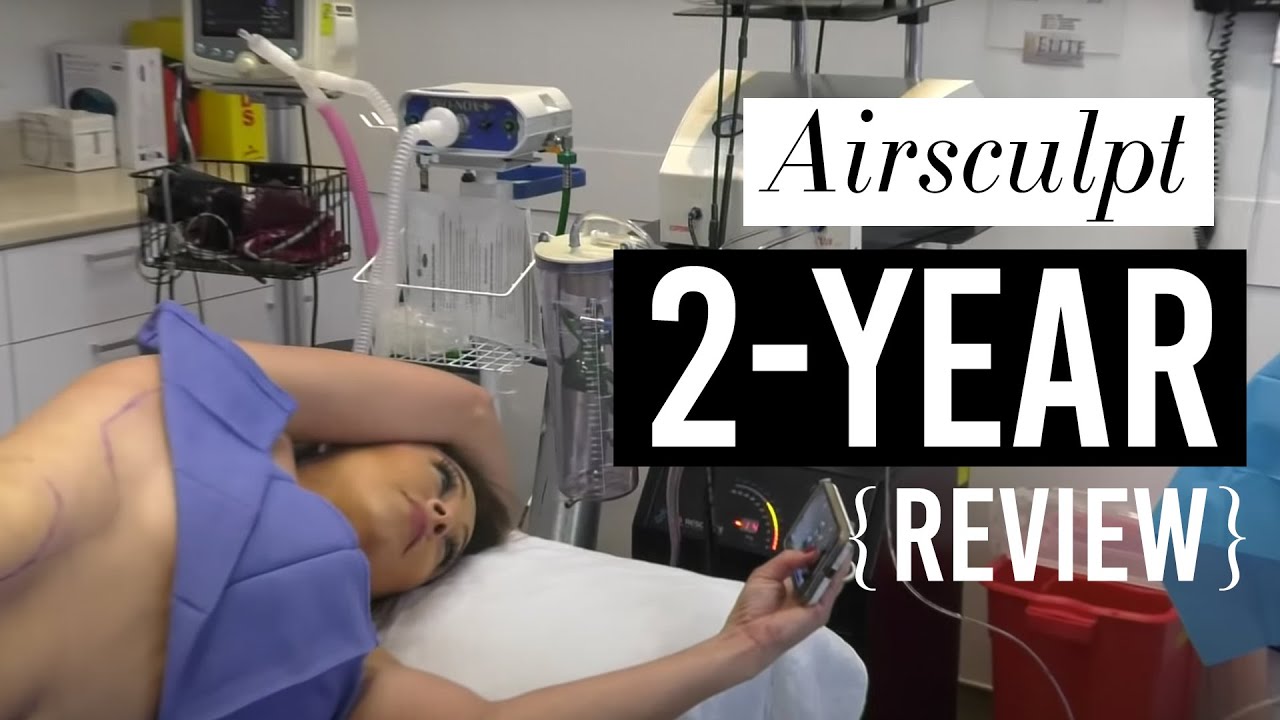 Airsculpt 2-Year Review: Would I do it all over again? (Before & After